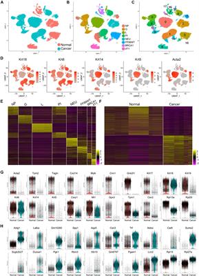 Ribosome Proteins Represented by RPL27A Mark the Development and Metastasis of Triple-Negative Breast Cancer in Mouse and Human